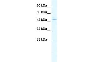 WB Suggested Anti-CLIC5 Antibody Titration:  1. (CLIC5 anticorps  (Middle Region))