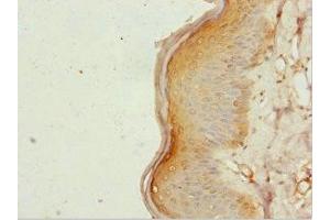 Immunohistochemistry of paraffin-embedded human skin tissue using ABIN7161952 at dilution of 1:100 (ZC3HC1 anticorps  (AA 1-260))