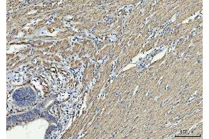 IHC analysis of TP53I13 using anti-TP53I13 antibody (ABIN7601220). (TP53I13 anticorps  (AA 30-365))