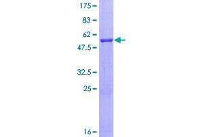 Image no. 1 for Exosome Component 4 (EXOSC4) (AA 1-245) protein (GST tag) (ABIN1353240)
