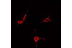 ABIN6274754 staining COLO205 cells by IF/ICC. (RPS27L anticorps  (N-Term))