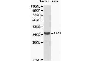 Western Blotting (WB) image for anti-Corticotropin Releasing Hormone (CRH) (AA 25-194) antibody (ABIN6215115) (CRH anticorps  (AA 25-194))