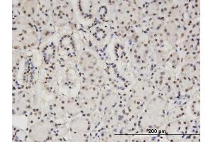 Immunoperoxidase of monoclonal antibody to CBFA2T2 on formalin-fixed paraffin-embedded human salivary gland. (CBFA2T2 anticorps  (AA 201-304))