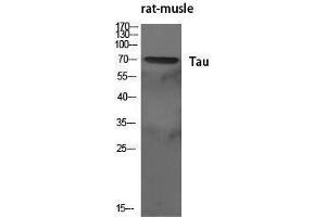 Western Blotting (WB) image for anti-tau Protein (Ser83) antibody (ABIN3187174) (tau anticorps  (Ser83))