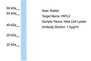 Image no. 1 for anti-Protein Associated with Topoisomerase II Homolog 2 (PATL2) (AA 313-362) antibody (ABIN6750126) (PATL2 anticorps  (AA 313-362))