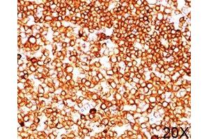 IHC testing of human tonsil (20X) stained with CD79a antibody (JCB117). (CD79a anticorps  (AA 202-216))