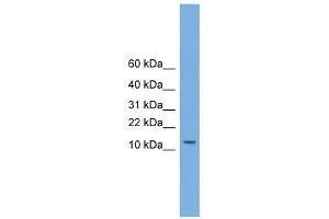 MAGEA5 antibody used at 1 ug/ml to detect target protein. (MAGEA5 anticorps  (N-Term))