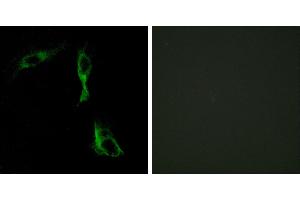 Peptide - +Immunohistochemistry analysis of paraffin-embedded human breast carcinoma tissue using ADRA1D antibody. (ADRA1D anticorps)