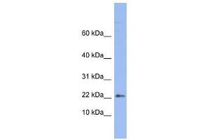 RPS24 antibody used at 1 ug/ml to detect target protein. (RPS24 anticorps  (Middle Region))
