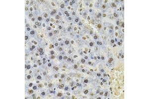 Immunohistochemistry of paraffin-embedded rat liver using PSMC3 Antibody (ABIN3022704, ABIN3022705, ABIN3022706 and ABIN6219146) at dilution of 1:100 (40x lens).