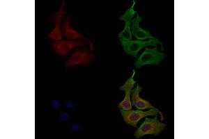 ABIN6266035 and ABIN6268862 staining Hela cells by IF/ICC.