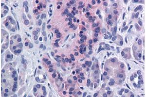 Human Pancreas: Formalin-Fixed, Paraffin-Embedded (FFPE)