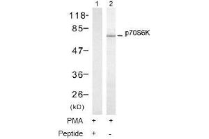 Image no. 1 for anti-Ribosomal Protein S6 Kinase, 70kDa, Polypeptide 1 (RPS6KB1) (Thr421) antibody (ABIN197498) (RPS6KB1 anticorps  (Thr421))