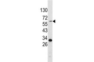 Western blot analysis of Tyrosinase antibody and HepG2 lysate.