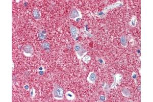 anti-Solute Carrier Family 25, Member 28 (SLC25A28) (C-Term) antibody