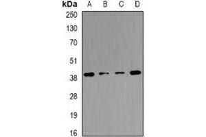 Western blot analysis of Tropomodulin-4 expression in mouse heart (A), mouse skeletal muscle (B), mouse brain (C), rat skeletal muscle (D) whole cell lysates. (Tropomodulin 4 anticorps)
