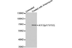 Western Blotting (WB) image for anti-Activating Transcription Factor 2 (ATF2) (pThr53) antibody (ABIN1869992) (ATF2 anticorps  (pThr53))