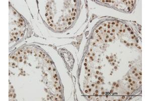 Immunoperoxidase of purified MaxPab antibody to TCF19 on formalin-fixed paraffin-embedded human testis.
