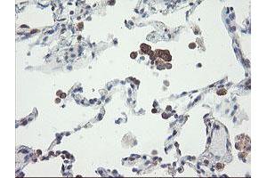 Image no. 15 for anti-Prefoldin Subunit 3 (PFDN3) antibody (ABIN1501702)