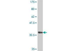 Western Blot detection against Immunogen (38.
