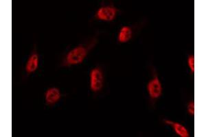 ABIN6274536 staining NIH-3T3 by IF/ICC. (DBF4 anticorps  (Internal Region))