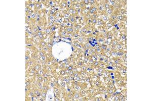 Immunohistochemistry of paraffin-embedded mouse liver using Leptin Receptor Rabbit mAb (ABIN7268210) at dilution of 1:100 (40x lens).