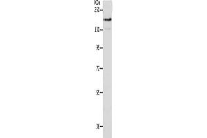Gel: 10 % SDS-PAGE, Lysate: 40 μg, Lane: A549 cells, Primary antibody: ABIN7191635(NFASC Antibody) at dilution 1/400, Secondary antibody: Goat anti rabbit IgG at 1/8000 dilution, Exposure time: 1 minute (NFASC anticorps)