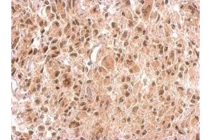IHC-P Image VHL antibody detects VHL protein at on U373 xenograft by immunohistochemical analysis.