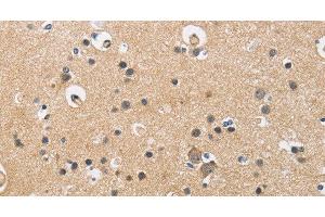 Immunohistochemistry of paraffin-embedded Human brain using CKMT2 Polyclonal Antibody at dilution of 1:60 (CKMT2 anticorps)