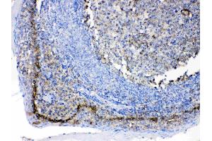 IHC analysis of CD147/Emmprin using anti-CD147/Emmprin antibody .