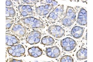 ABIN7094824 and ABIN7098875 at 1/100 staining Rat colorectal tissue by IHC-P.