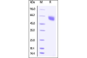 Biotinylated Human BTLA (31-134), Fc Tag on SDS-PAGE under reducing (R) condition.
