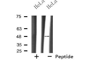 Western blot analysis of extracts from HeLa cells, using OPRM1 antibody. (Mu Opioid Receptor 1 anticorps  (C-Term))