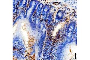IHC analysis of CD31/Pecam1 using anti-CD31/Pecam1 antibody (ABIN7601662). (CD31 anticorps  (AA 41-258))