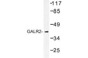 Image no. 1 for anti-Galanin Receptor 2 (GALR2) antibody (ABIN317752) (GALR2 anticorps)