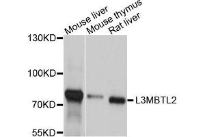 Western blot analysis of extract of various cells, using L3MBTL2 antibody. (L3MBTL2 anticorps)