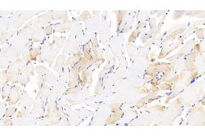 Detection of GDF5 in Human Skeletal muscle Tissue using Polyclonal Antibody to Growth Differentiation Factor 5 (GDF5)