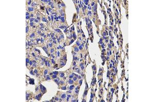 Immunohistochemistry of paraffin-embedded mouse lung cancer using KLRD1 antibody at dilution of 1:200 (x400 lens) (CD94 anticorps)