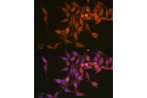 Immunofluorescence analysis of HeLa cells using PSMB6 Polyclonal Antibody (ABIN1682336, ABIN3018469, ABIN3018470 and ABIN6220475) at dilution of 1:100 (40x lens). (PSMB6 anticorps  (AA 35-239))
