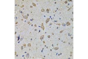 Immunohistochemistry of paraffin-embedded mouse brain using EIF4A2 antibody. (EIF4A2 anticorps  (AA 1-270))