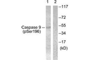 Western blot analysis of extracts from 293 cells treated with Calyculin 50nM 30', using Caspase 9 (Phospho-Ser196) Antibody. (Caspase 9 anticorps  (pSer196))
