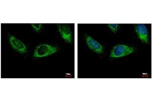 ICC/IF Image HPS3 antibody [C3], C-term detects HPS3 protein at cytoplasm by immunofluorescent analysis. (HPS3 anticorps  (C-Term))