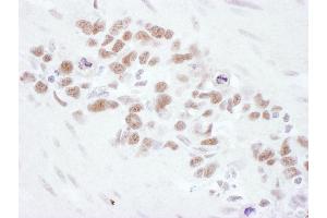Immunohistochemistry (IHC) image for anti-MRE11 Meiotic Recombination 11 Homolog A (S. Cerevisiae) (MRE11A) (AA 658-708) antibody (ABIN7454999)