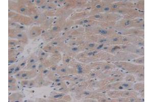 IHC-P analysis of Human Liver Tissue, with DAB staining. (AKT2 anticorps  (AA 142-412))