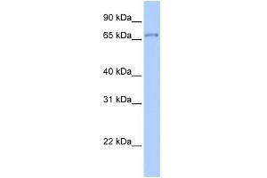 WB Suggested Anti-ZNF76 Antibody Titration:  0. (ZNF76 anticorps  (Middle Region))
