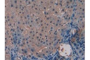 Detection of ALT in Human Liver Tissue using Polyclonal Antibody to Alanine Aminotransferase (ALT)