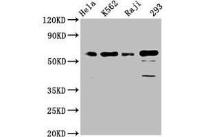 Western Blot Positive WB detected in: Hela whole cell lysate, K562 whole cell lysate, Raji whole cell lysate, 293 whole cell lysate All lanes: Cdc25C antibody at 1. (Recombinant CDC25C anticorps)