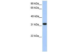 ETFA antibody used at 1 ug/ml to detect target protein. (ETFA anticorps)