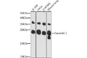 Western blot analysis of extracts of various cell lines, using Caveolin-1 antibody (ABIN6131271, ABIN6137992, ABIN6137993 and ABIN6218615) at 1:3000 dilution. (Caveolin-1 anticorps  (AA 1-100))