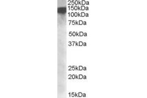 EB09297 (1µg/ml) staining of nuclear HeLa lysate (35µg protein in RIPA buffer). (DHX9 anticorps  (Internal Region))
